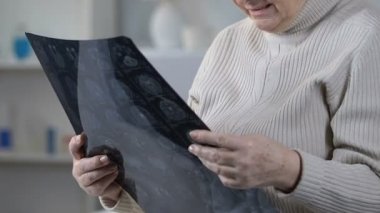 Üst düzey kadın beyin x-ray seyir ve ağlama, onkolojik hastalığı acı