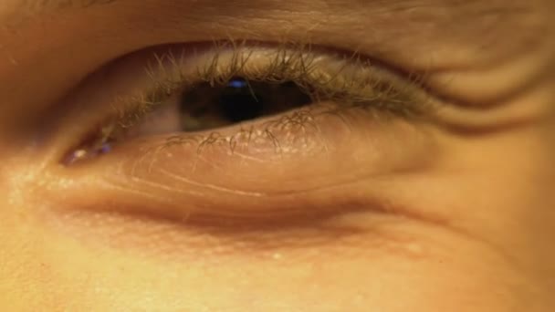 Joven Con Mala Visión Ojos Entrecerrados Oftalmología Primer Plano Extremo — Vídeo de stock