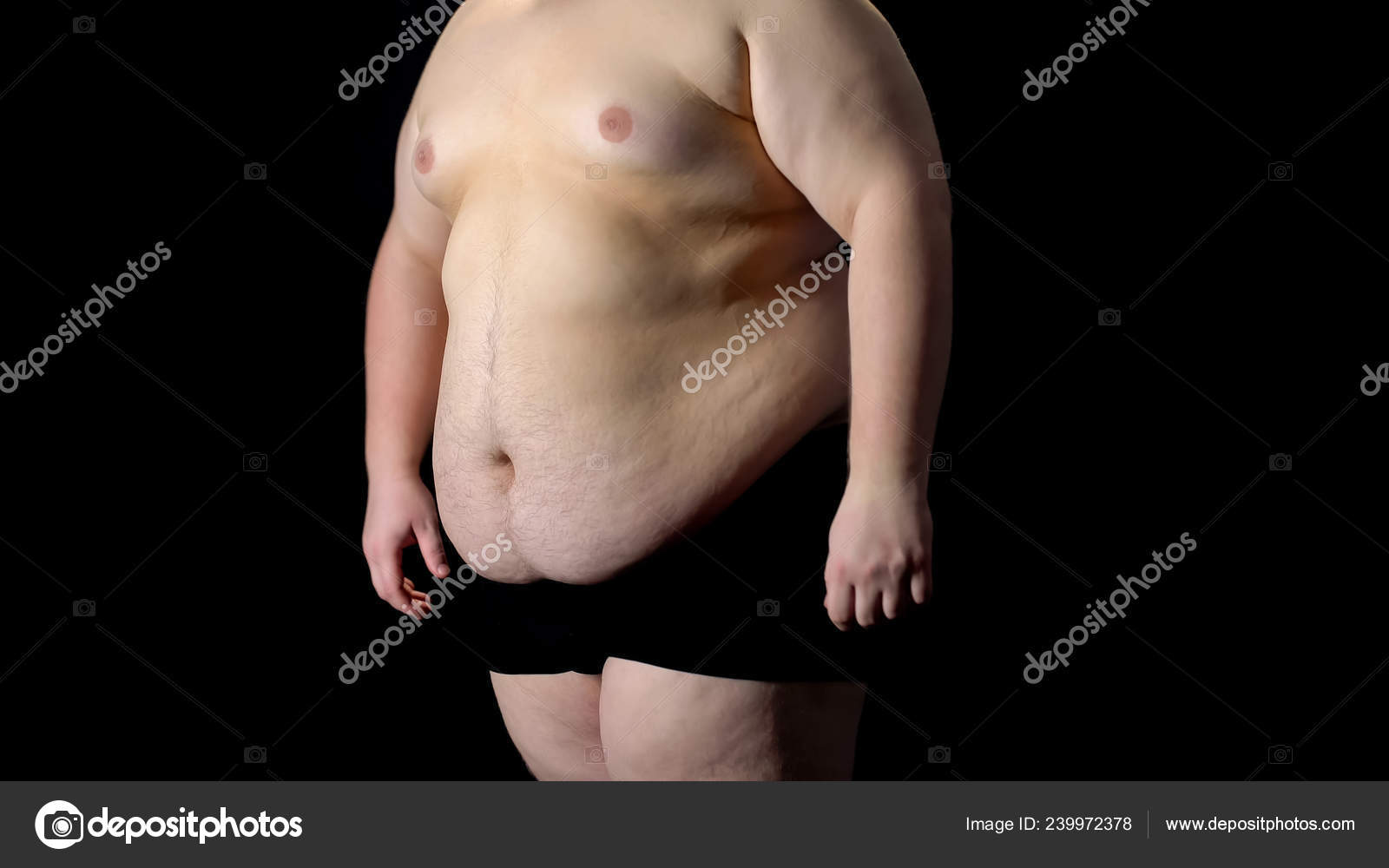 Vista Para Homem Barriga Gorda Distúrbio Metabólico Ressecção Estômago  Lipoaspiração — Foto © motortion #239972378, image size:1600x1000