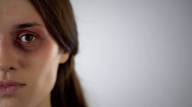 Çürük kadınla ne yazık ki, Aile içi şiddet kamera sosyal istatistik görünüyor