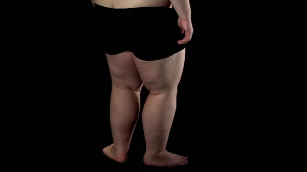Rückansicht Übergewichtigen Männerbeinen Auf Dunklem Hintergrund Problemen Unsicherheiten — Stockfoto