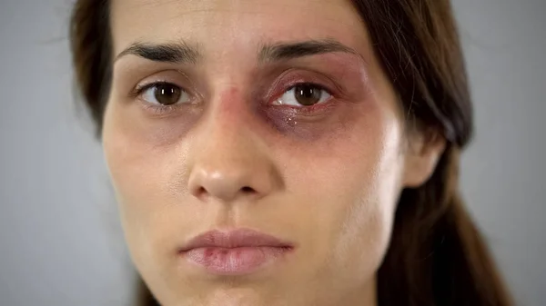 Dama Herida Llorando Cara Magullada Cerca Problema Violencia Doméstica Conciencia — Foto de Stock