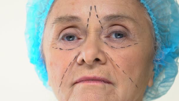 脸上有手术痕迹的老年女病人 整形外科医生拿着手术刀 — 图库视频影像