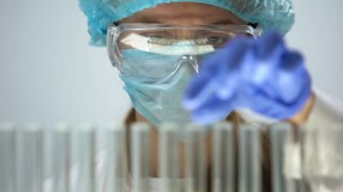 Tüp idrar örneği ile işaretleme, bilirubin düzeyi kontrol tıbbi laboratuar işçisi