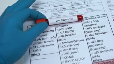 Karaciğer enzim, Doktor laboratuvar boş, gösteren kan örneğinde tüp içinde ad denetimi