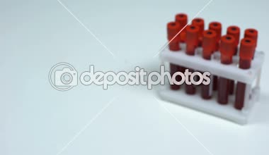 Kuş gribi testi, Doktor gösteren kan örneği tüp, laboratuvar araştırma sağlık check-up