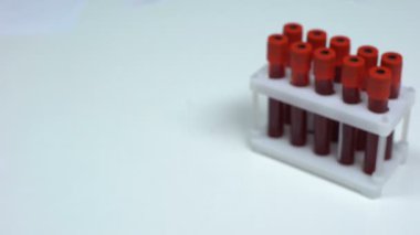 Negatif adenovirus, Doktor gösteren kan örneği, laboratuvar araştırma, sağlık