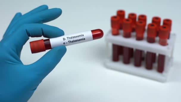 B- talassemia, médico mostrando amostra de sangue, pesquisa de laboratório, exame de saúde — Vídeo de Stock