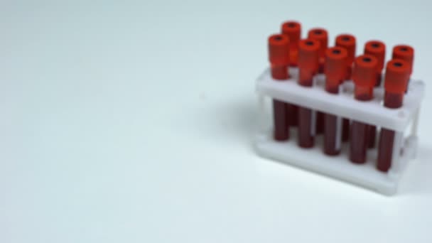Тест птичьего гриппа, доктор показывает образец крови в трубке, лабораторный осмотр здоровья — стоковое видео