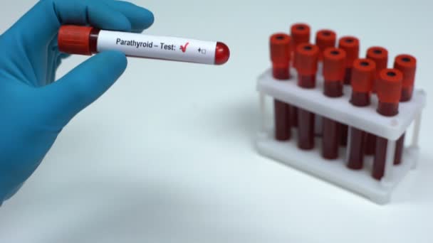 Prueba paratiroidea negativa, médico mostrando muestra de sangre, investigación de laboratorio, atención médica — Vídeos de Stock