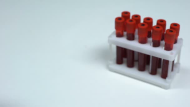 Отрицательный тест G6PD, доктор показывает образец крови, лабораторные исследования, медицинский осмотр — стоковое видео