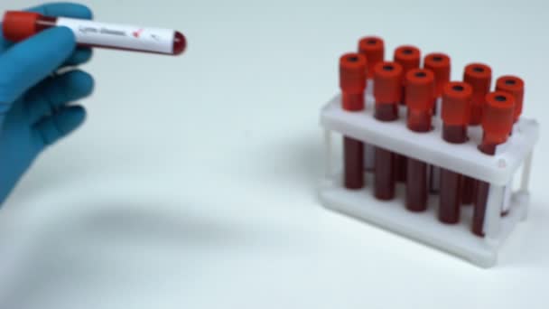 Negativo test della malattia di Lyme, medico mostrando campione di sangue, laboratorio di ricerca sanitaria — Video Stock