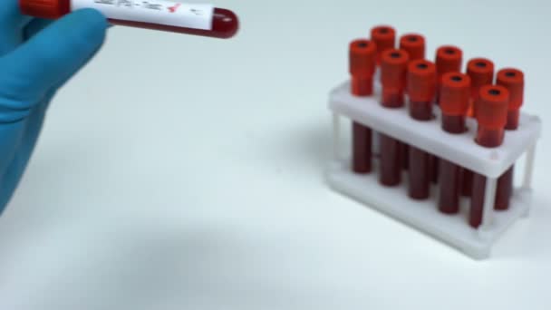 Отрицательный тест на свинец (pb), доктор, показывающий образец крови, лабораторные исследования, здравоохранение — стоковое видео
