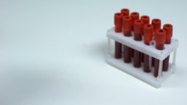 Test CMV negativo, medico che mostra il campione di sangue, ricerca di laboratorio, controllo dello stato di salute — Video Stock