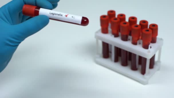 Teste de legionela negativa, médico mostrando amostra de sangue, pesquisa de laboratório, cuidados de saúde — Vídeo de Stock