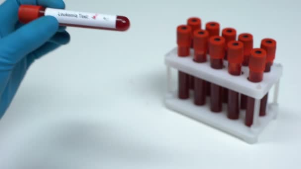 Teste de leucemia negativa, médico mostrando amostra de sangue, pesquisa laboratorial, cuidados de saúde — Vídeo de Stock