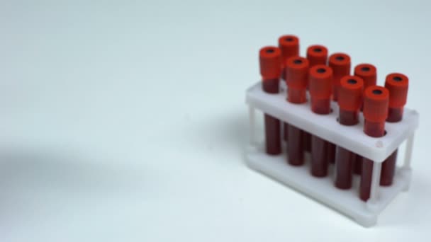 EV 71 negativo, medico che mostra il campione di sangue, ricerca di laboratorio, controllo dello stato di salute — Video Stock