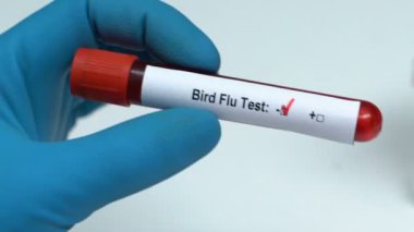 Kuş gribi testi, kan örneği tüp yakın çekim, sağlık check-up tutan doktor