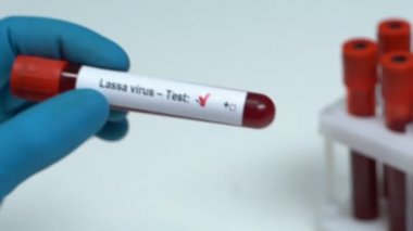 Lassa virüs-testi, kan örneği tüp yakın çekim, sağlık check-up tutan doktor
