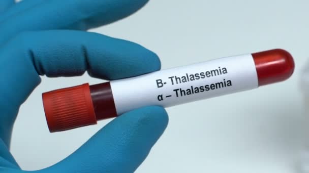Thalassemi, läkare håller blodprov i tube närbild, hälsokontroll — Stockvideo