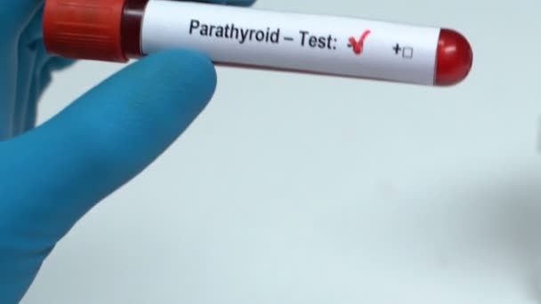 Parathyroid, dokter memegang sampel darah di tabung close-up, pemeriksaan kesehatan — Stok Video