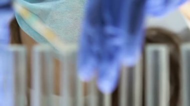 Tıbbi çalışan test tüpü ile idrar örneği, ph dengesini turnusol kağıdı koyarak