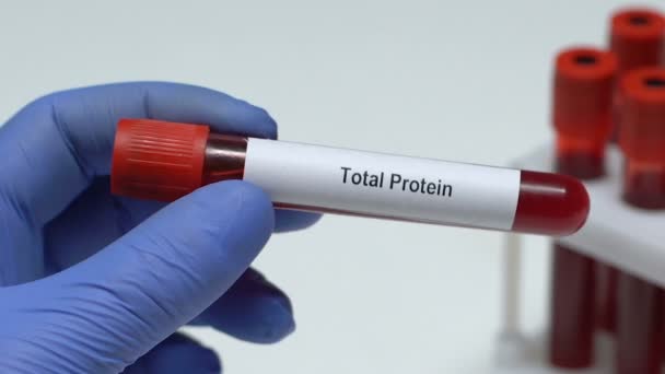 Total Protein, medico che tiene il campione di sangue nel tubo primo piano, controllo dello stato di salute — Video Stock