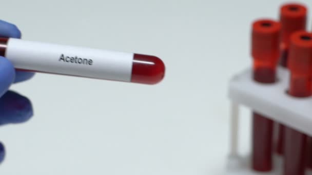 Acétone, travailleur de laboratoire tenant un échantillon de sang dans un tube gros plan, bilan de santé — Video