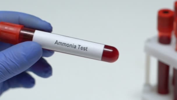 Teste de amônia, médico segurando amostra de sangue em close-up tubo, check-up de saúde — Vídeo de Stock