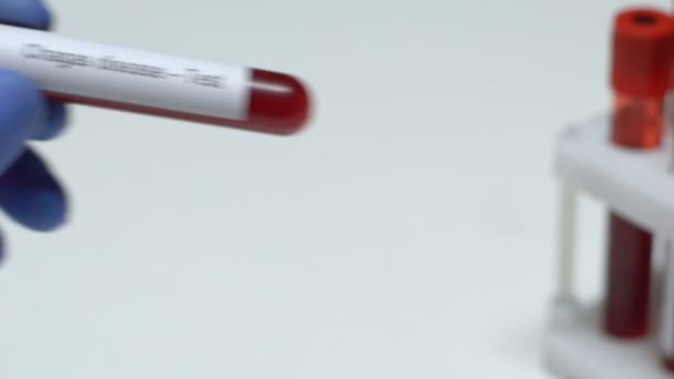 Maladie de Chagas-Test, médecin tenant un échantillon de sang dans le gros plan du tube, santé — Video