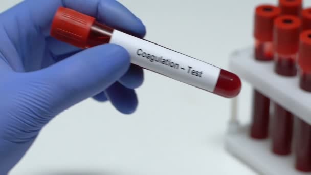 Коагуляція-тест, лікар тримає зразок крові в трубці крупним планом, огляд здоров'я — стокове відео