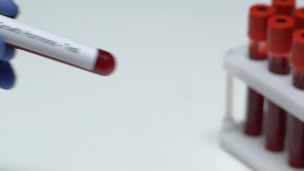 Teste de hormona de crescimento, médico segurando amostra de sangue em close-up tubo, saúde — Vídeo de Stock