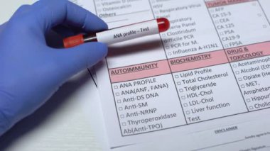 Ana profil, Doktor laboratuvar tüpü kan örneği gösterilen boş hastalığında kontrol