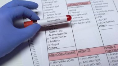 N meningitidis, Doktor laboratuvar boş, gösteren kan örneği hastalığında kontrol
