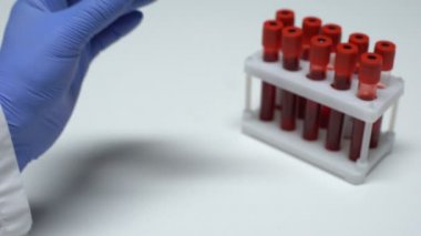 RBC testi, tüp, laboratuvar araştırma, sağlık muayenesi doktor gösteren kan örneğinde