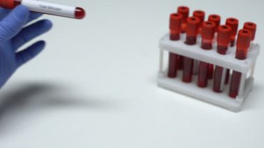 Toplam bilirubin, Doktor kan örneği gösterir tüp, laboratuvar araştırma, sağlık muayenesi