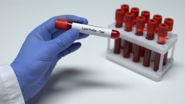 Lipidprofilen, läkare visar blodprov i tube, lab forskning, hälsokontroll — Stockvideo