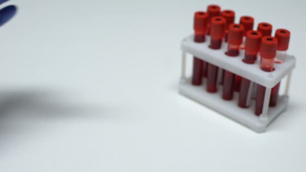 ESR-prøve, lege som viser blodprøve i sonde, laboratorieundersøkelse, helseundersøkelse – stockvideo