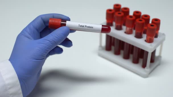 Proteína total, médico mostrando muestra de sangre en tubo, investigación de laboratorio, chequeo de salud — Vídeo de stock