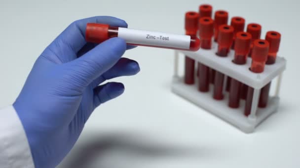Test de zinc, médecin montrant un échantillon de sang dans le tube, recherche en laboratoire, bilan de santé — Video