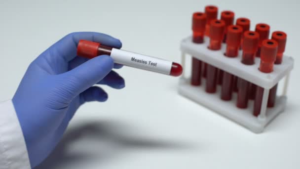 Prueba de sarampión, médico mostrando muestra de sangre en tubo, investigación de laboratorio, chequeo de salud — Vídeos de Stock