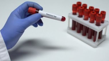 Rotavirüs testi, Doktor kan örneği gösterir tüp, laboratuvar araştırma, sağlık muayenesi