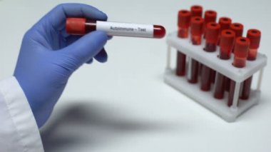 Otoimmün, tüp, laboratuvar araştırma, sağlık muayenesi doktor gösteren kan örneğinde