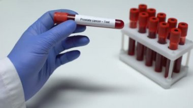 Prostat kanseri, Doktor kan örneği gösterir tüp, laboratuvar araştırma, sağlık muayenesi