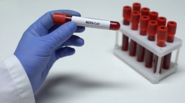 Mers-Cov, tüp, laboratuvar araştırma, sağlık muayenesi doktor gösteren kan örneğinde