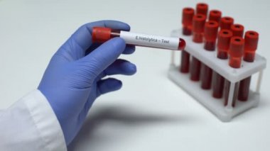 E histolytica, tüp, laboratuvar araştırma, sağlık muayenesi doktor gösteren kan örneğinde