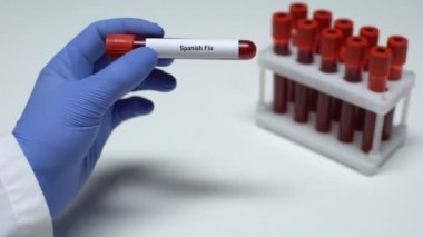 İspanyol gribi, tüp, laboratuvar araştırma, sağlık muayenesi doktor gösteren kan örneğinde