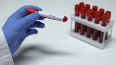 Je virüs, tüp, laboratuvar araştırma, sağlık muayenesi doktor gösteren kan örneğinde