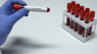 N menenjit, tüp, laboratuvar araştırma, sağlık muayenesi doktor gösteren kan örneğinde