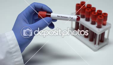 Seks hormonu, tüp, laboratuvar araştırma, sağlık muayenesi doktor gösteren kan örneğinde